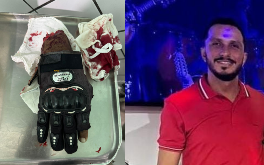 Ataque brutal: homem decepa mão de mototaxista em plena luz do dia em Castanhal